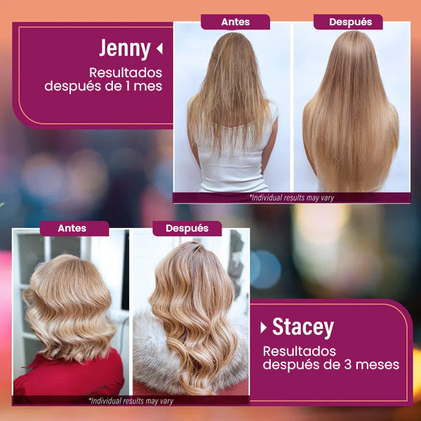 HAIR GROWTH - ENVÍO GRATIS 💁♀️😍